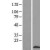 Western Blot: S100A3 Lysate [NBL1-15655] - Western Blot experiments.  Left-Control; Right -Over-expression Lysate for S100A3.